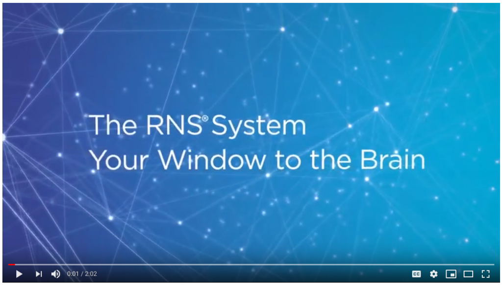 How the RNS System Works